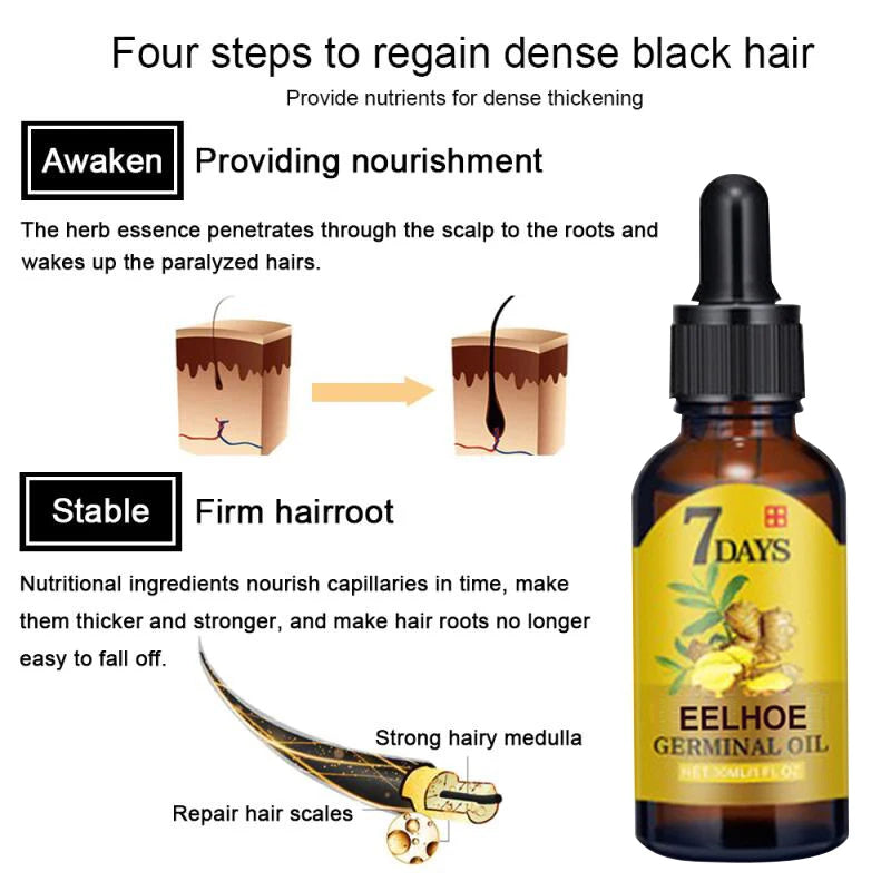 Haarwuchs Serum schnell wachsendes Haar ätherisches Öl Schönheit Haarpflege/40ml dichtes Nachwachsen Ingwer Haar fördert die Regeneration