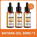 Lewedo Naturals Batana-Öl, schnelles Haarwachstum für Männer und Frauen, reines Batana-Öl, nährt glänzendes Haar, gesunde Haarpflege, Anti-Haarausfall