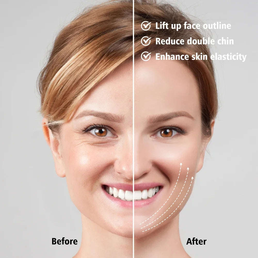 EMS Face Lifting Massagegerät Anti-Falten Straffendes Gesichtsmassagegerät V-Face Lift Gerät Mikrostromentferner Doppelkinn Hautpflege