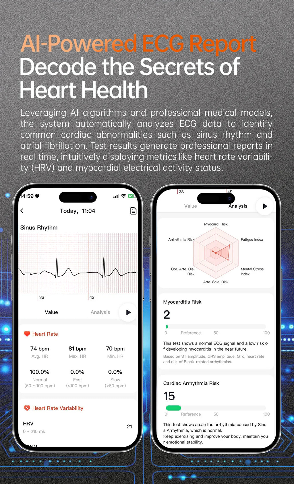 2025, neue EKG + PPG, Gesundheitsdiagnose, Smartwatches, Männer und Frauen, Uhr, Harnsäure, Lipid, BP, Herzfrequenz-Tracker, NFC, Sport-Smartwatch, IOS