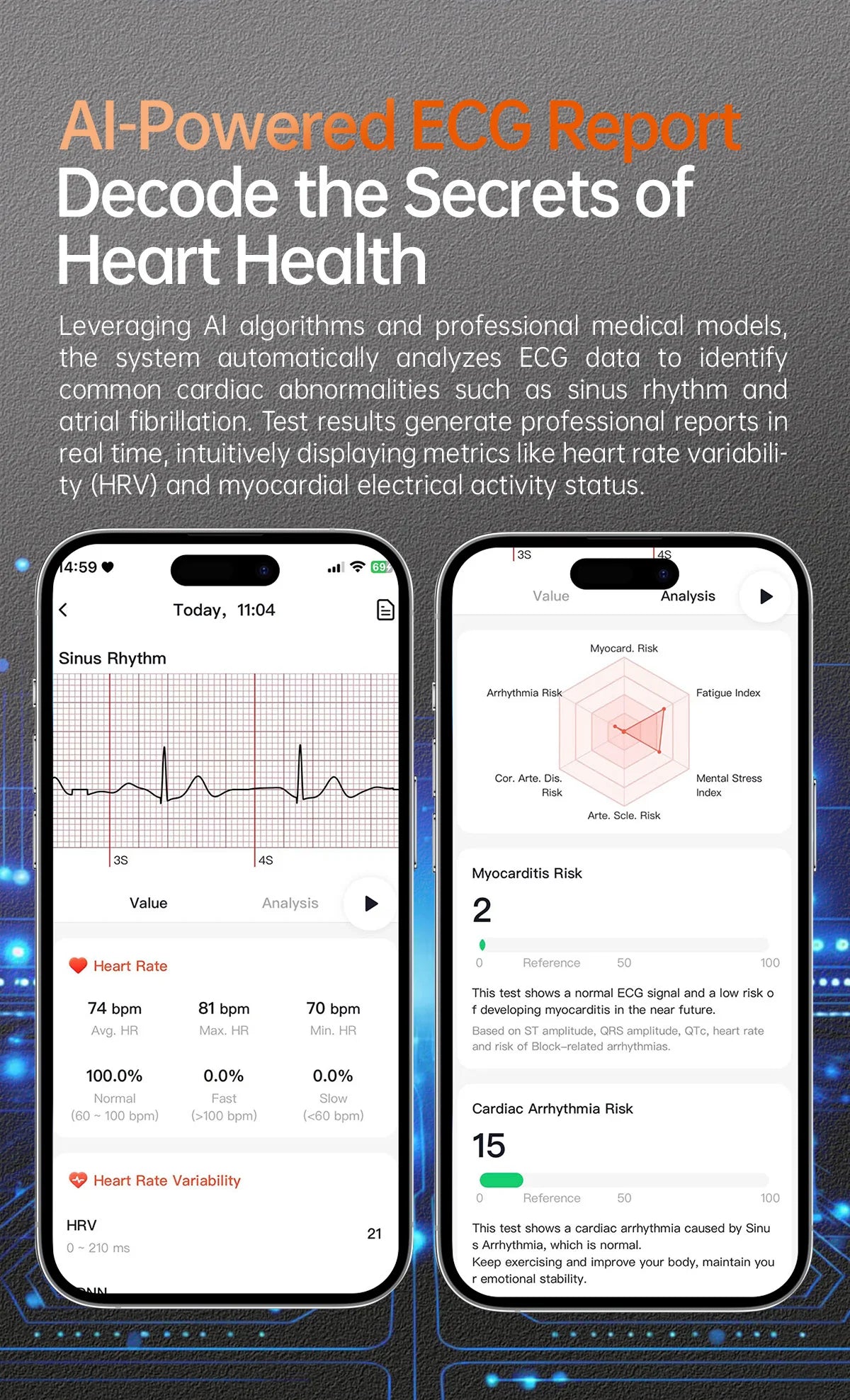 2025, neue EKG + PPG, Gesundheitsdiagnose, Smartwatches, Männer und Frauen, Uhr, Harnsäure, Lipid, BP, Herzfrequenz-Tracker, NFC, Sport-Smartwatch, IOS