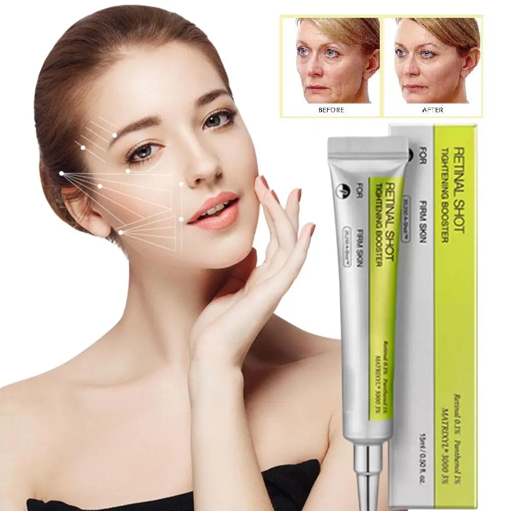 Koreanische Retinol Feuchtigkeitsspendende Essenz Peeling Augencreme Feuchtigkeitscreme Verjüngt Schrumpft Poren Moisturiz Erhellen Hautpflege