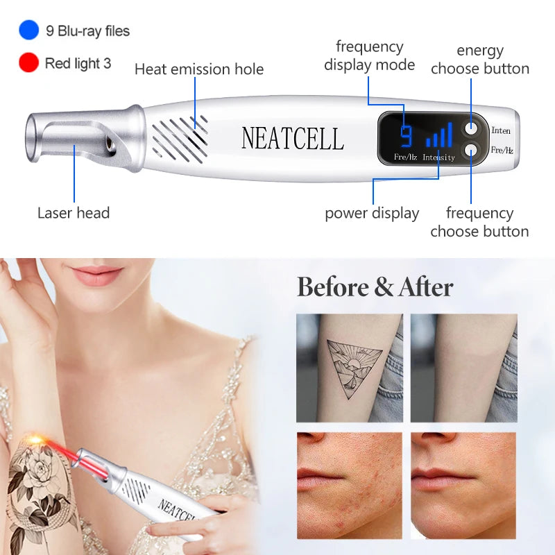 Pikosekunden-Laserpointer zur Entfernung von Maulwurfs, Stift zur Entfernung dunkler Flecken, Tattoo, Akne, Hautpigment, tragbare Entfernungsmaschine, Schönheitsgerät
