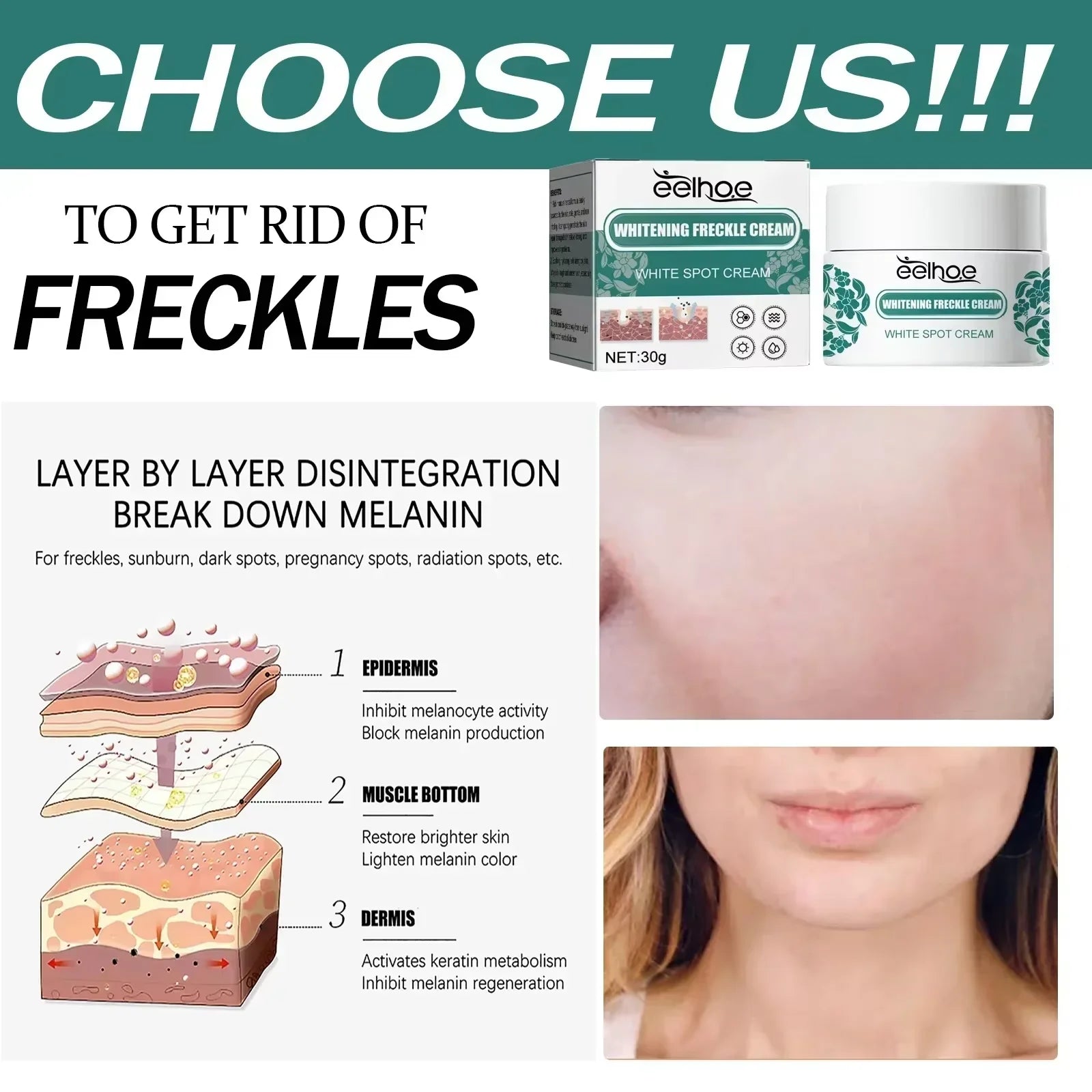 eelhoe Niacinamide Melasma Brightening Cream Reduce Melanin Brighten Cream Lighten Dark Skin Chloasma Serum Fade Fine Face Lines